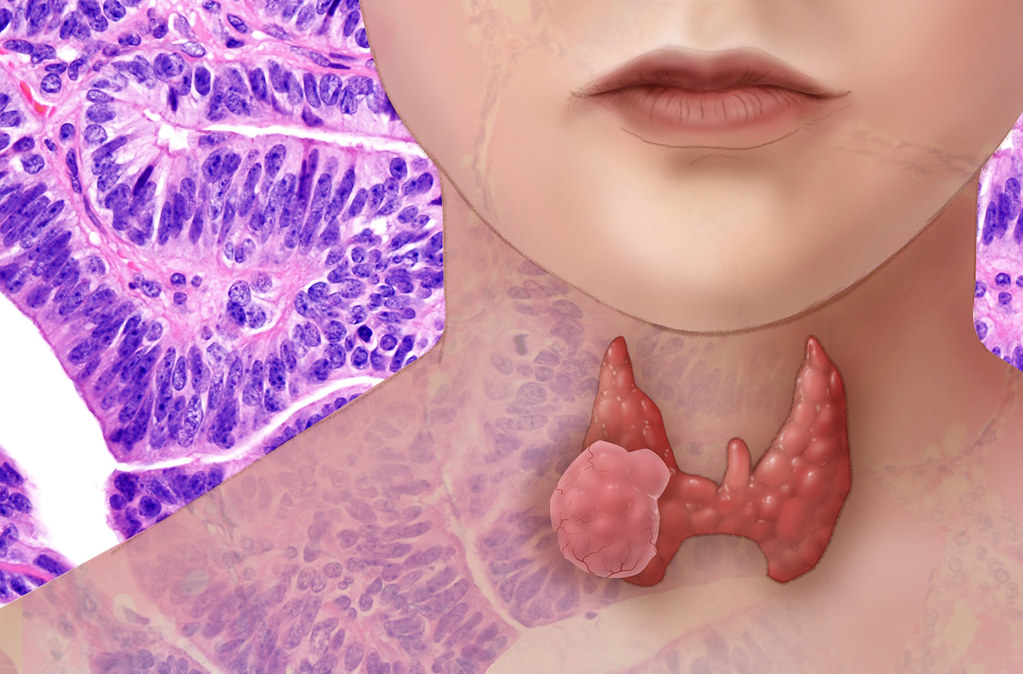 7 Common Causes of Thyroid Problem