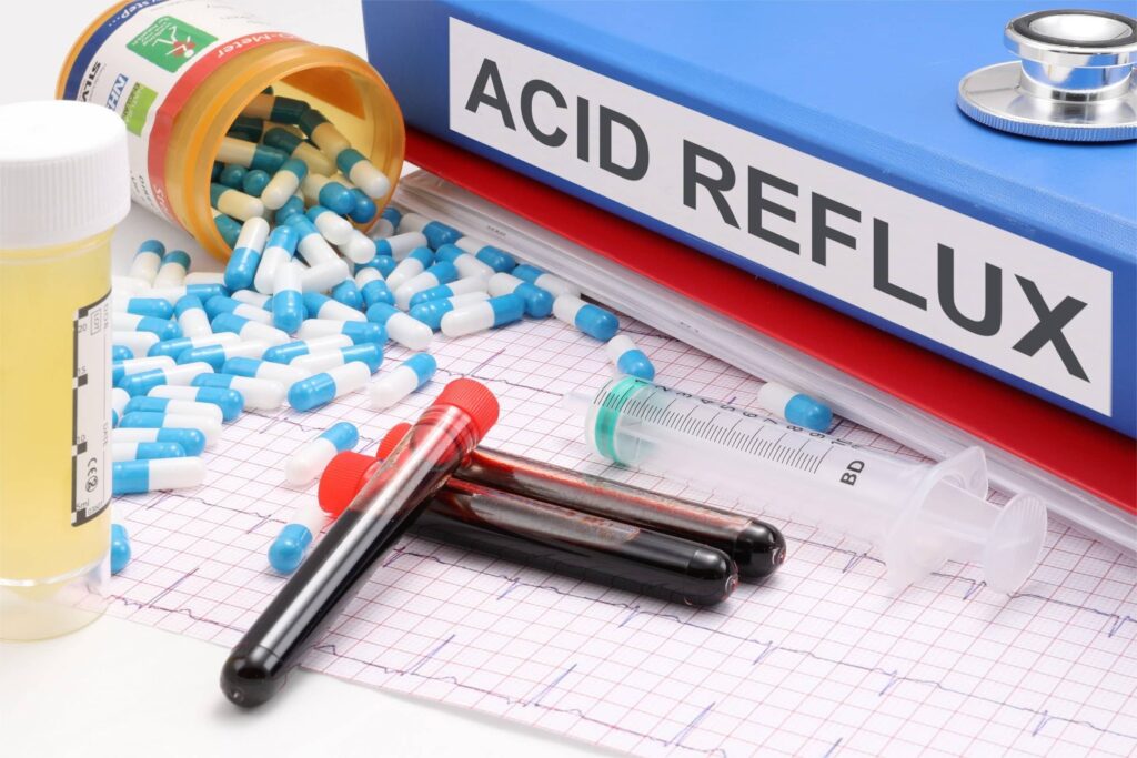 acid reflux symptoms causes and treatment