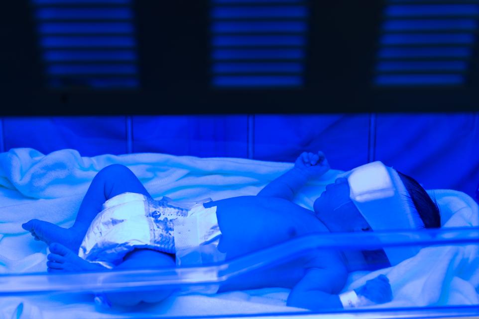 Treating Jaundice In Newborns