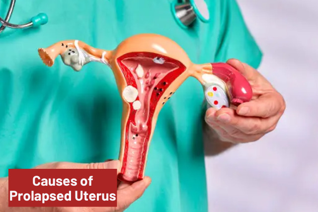 prolapsed uterus causes