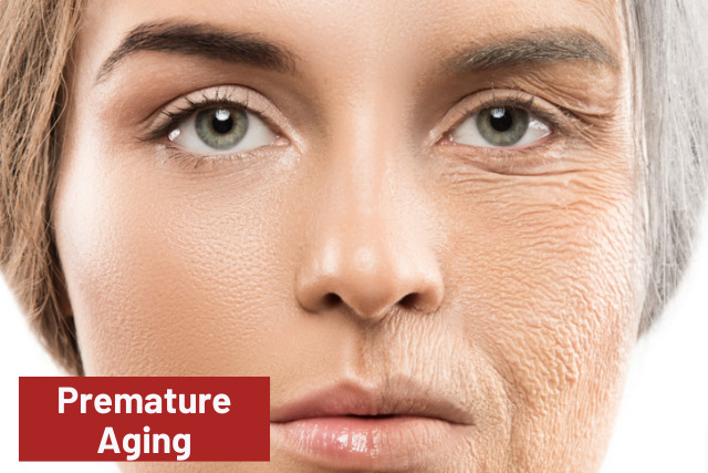 premature aging skin