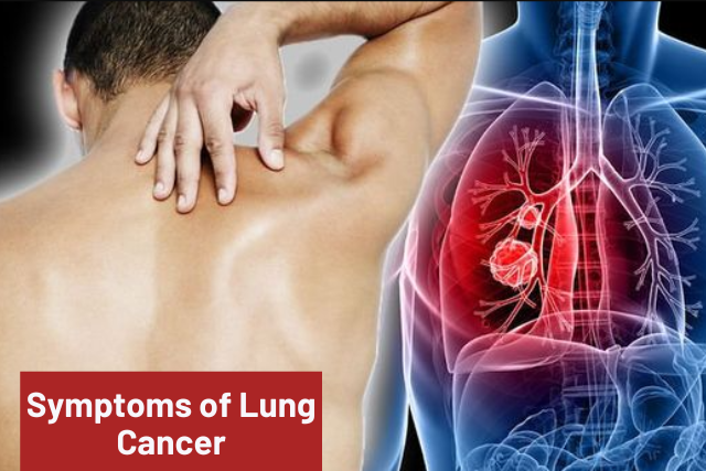 lung cancer diagnosis