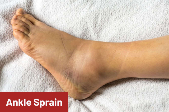 Ankle Sprain Podiatrist