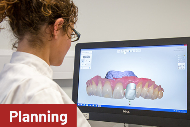 Dental Implant planning