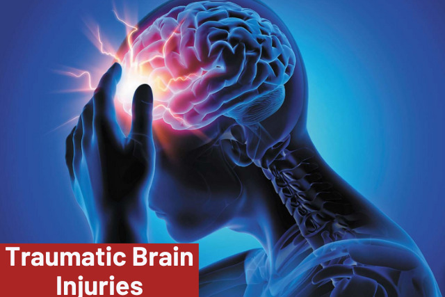 Brain Injuries 