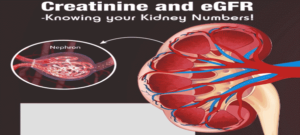 Causes of High Creatinine Levels: