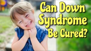 Is Down's syndrome curable?