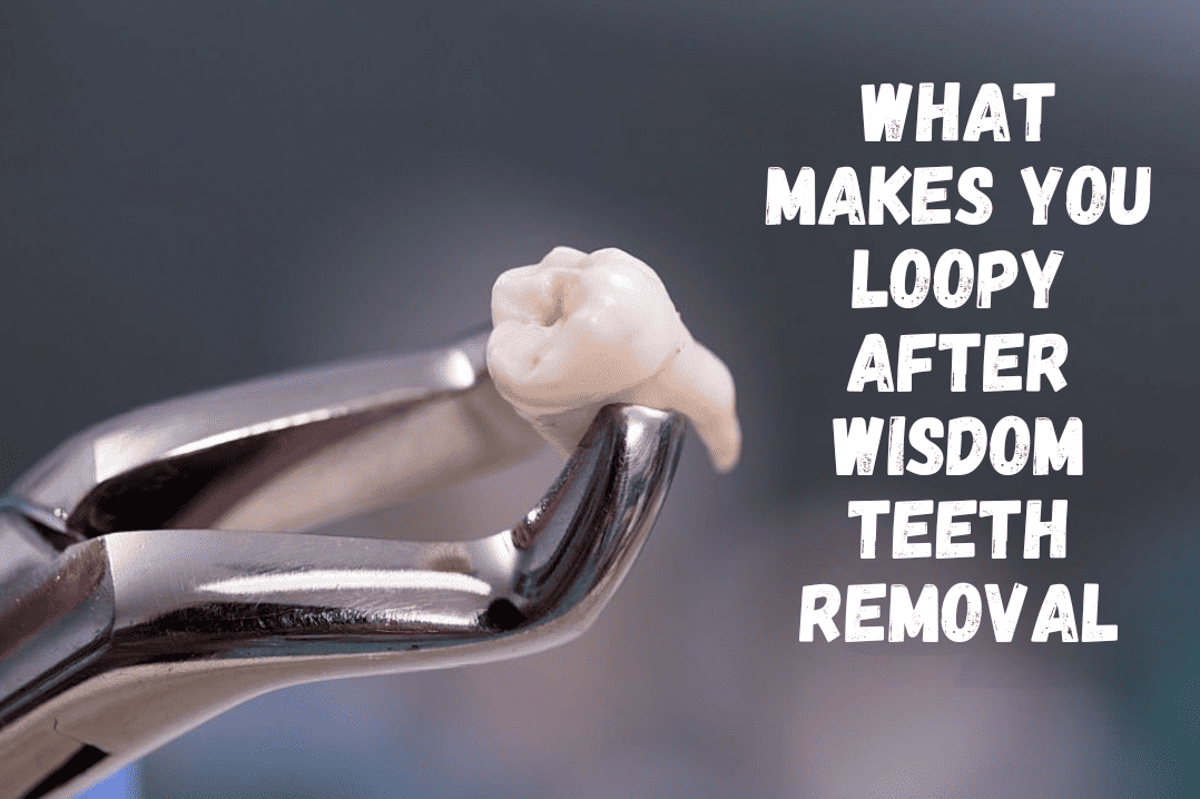 What Makes You Loopy After Wisdom Teeth Removal